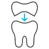 Carillas Dentales